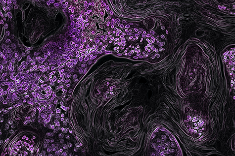 Microscopic view of a disease