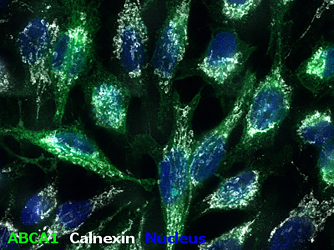ABCA 1 Calnexin Nucleus 