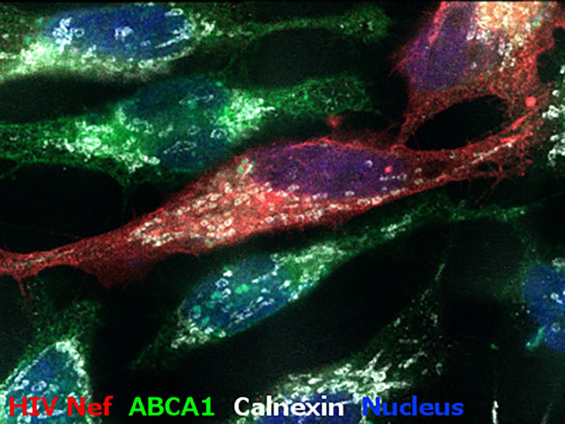 ABCA1 HIV Nef Nucleus Calnexin